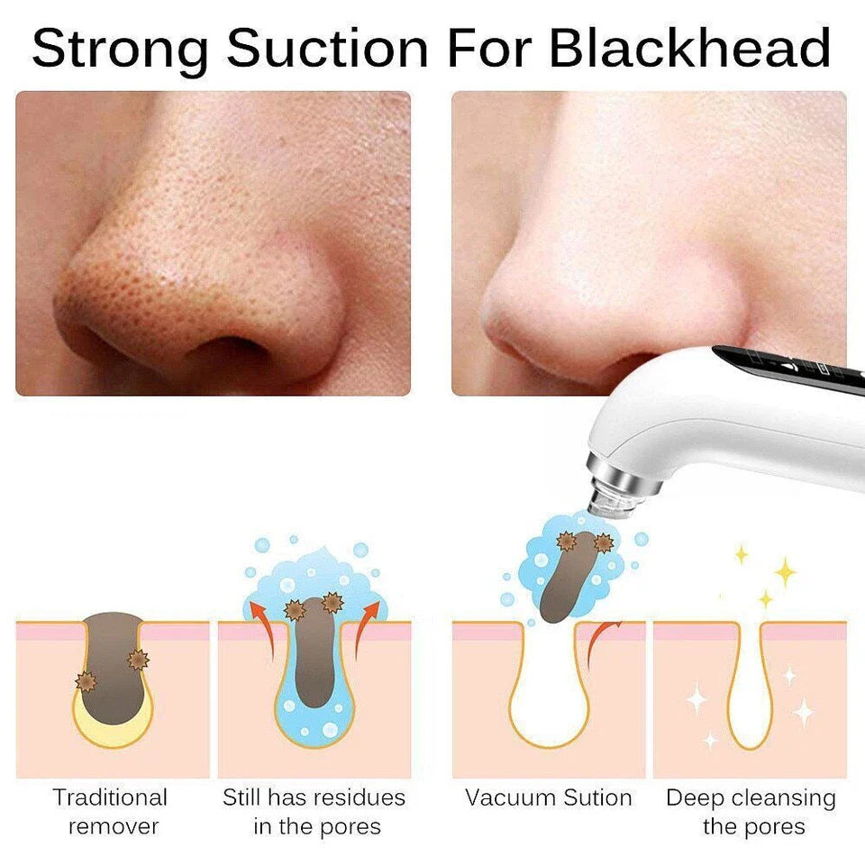 Bubble Facial & Blackhead Remover – Deep Pore Cleanser for Acne, Oil Control & Glowing Skin | Bubble Technology